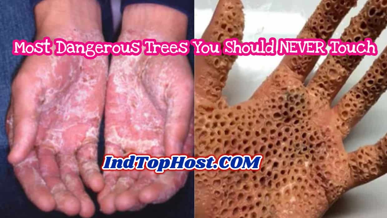 Most Dangerous Trees You Should NEVER Touch